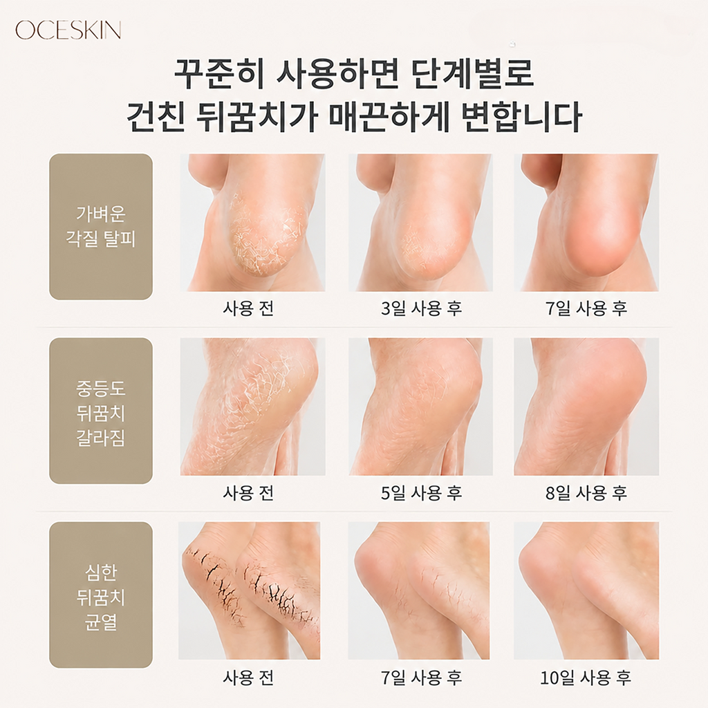 OCESKIN Moisturizing Socks Heel Moisturizing Pads 2 Pairs