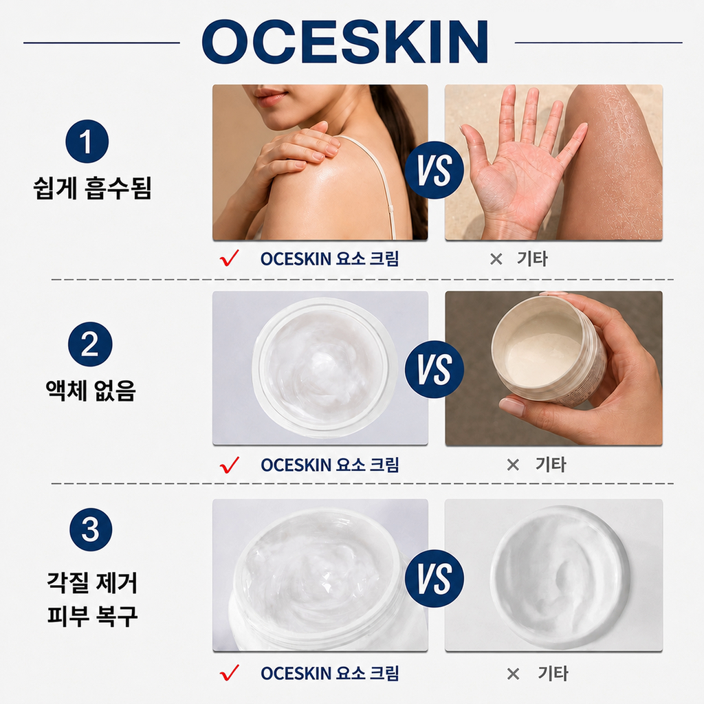 OCESKIN 40% Urea Cream Exfoliating Foot Cream 130g