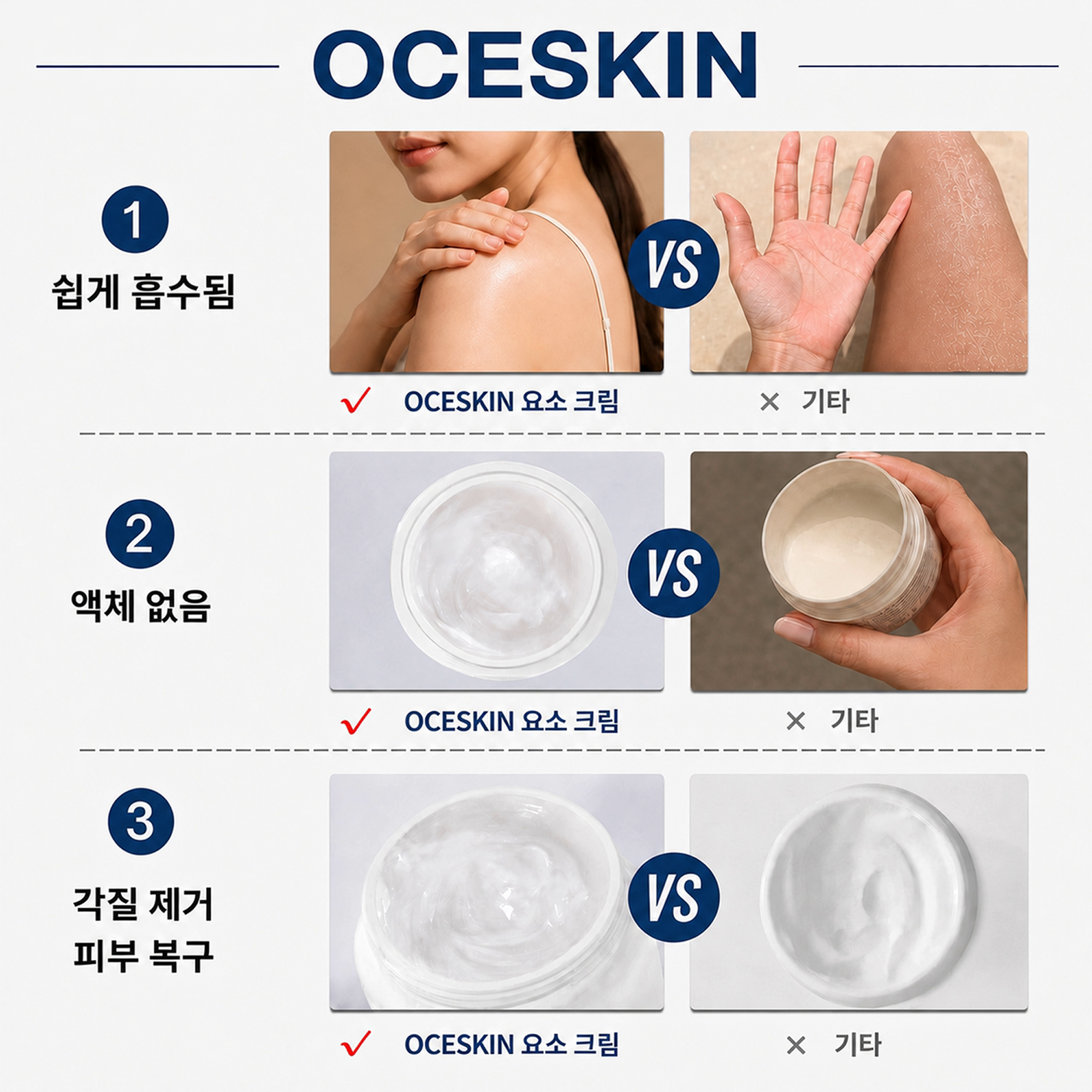 OCESKIN 40% Urea Cream Exfoliating Foot Cream 130g