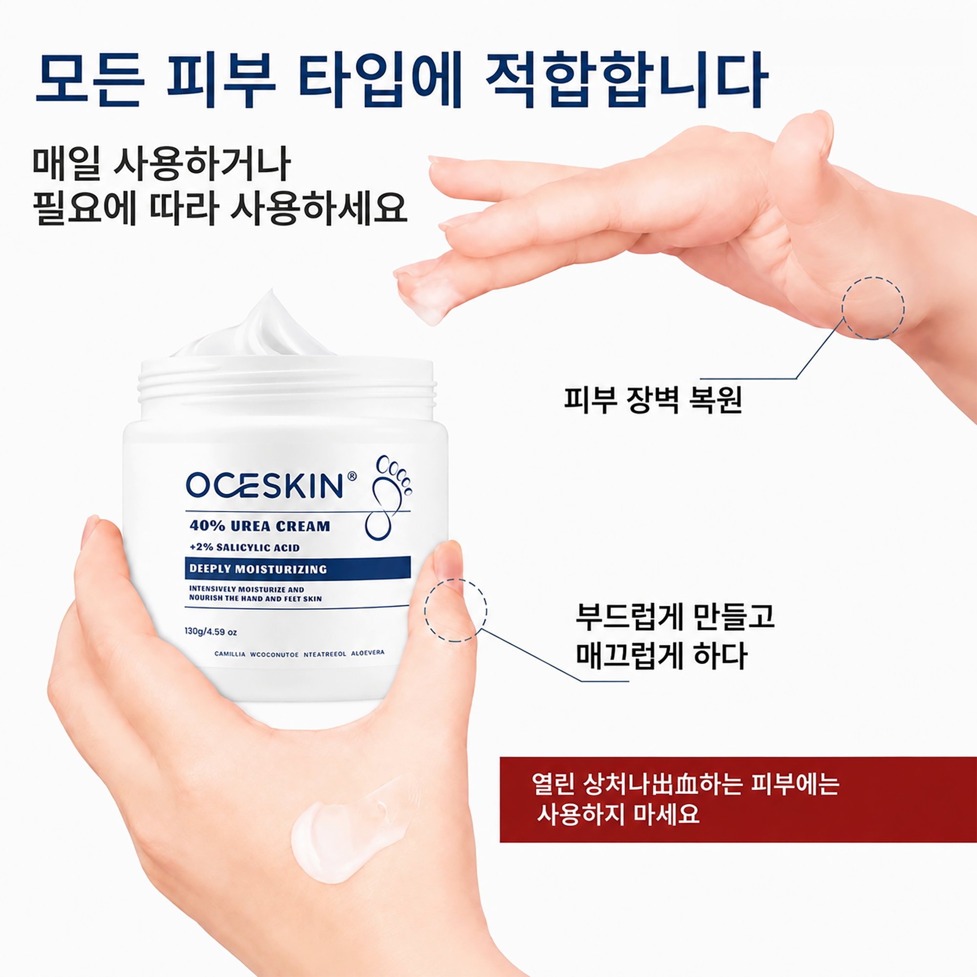 OCESKIN 40% Urea Cream Exfoliating Foot Cream 130g